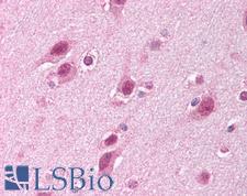 HUWE1 / ARFBP1 Antibody - Anti-HUWE1 antibody IHC of human brain, cortex. Immunohistochemistry of formalin-fixed, paraffin-embedded tissue after heat-induced antigen retrieval. Antibody concentration 5 ug/ml.