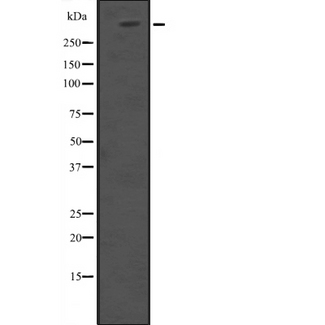 HUWE1 / ARFBP1 Antibody - Western blot analysis of HUWE1 expression in 293T whole cells lysate. The lane on the left is treated with the antigen-specific peptide.