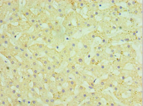 HYAL1 Antibody - Immunohistochemistry of paraffin-embedded human liver tissue using HYAL1 Antibody at dilution of 1:100