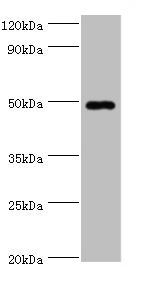 HYAL1 Antibody - Western blot All lanes: HYAL1 antibody at 2µg/ml + HepG2 whole cell lysate Secondary Goat polyclonal to rabbit IgG at 1/10000 dilution Predicted band size: 49, 46, 28, 24, 20, 11, 38 kDa Observed band size: 49 kDa