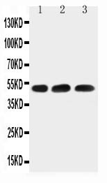 HYAL1 Antibody - HYAL1 antibody Western blot. Lane 1: HELA Cell Lysate. Lane 2: 22RV1 Cell Lysate. Lane 3: MCF-7 Cell Lysate.