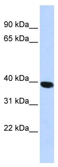 HYAL1 Antibody - Western analysis of HepG2 cell lysate.  This image was taken for the unconjugated form of this product. Other forms have not been tested.