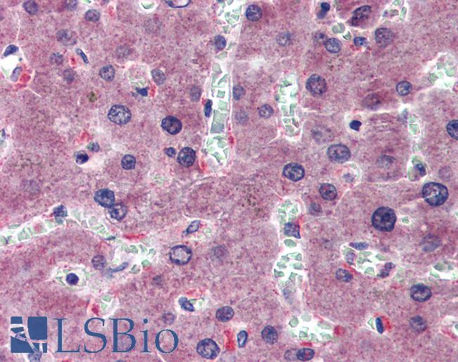 HYAL1 Antibody - Anti-HYAL1 antibody IHC of human liver. Immunohistochemistry of formalin-fixed, paraffin-embedded tissue after heat-induced antigen retrieval. Antibody concentration 5 ug/ml.  This image was taken for the unconjugated form of this product. Other forms have not been tested.
