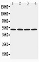 HYAL1 Antibody - HYAL1 antibody Western blot. Lane 1: NRK Cell Lysate. Lane 2: Mouse Liver Tissue Lysate. Lane 3: Mouse Kidney Tissue Lysate. Lane 4: SP2/0 Cell Lysate.
