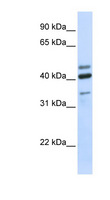 HYAL1 Antibody - HYAL1 antibody Western blot of Fetal Brain lysate. This image was taken for the unconjugated form of this product. Other forms have not been tested.