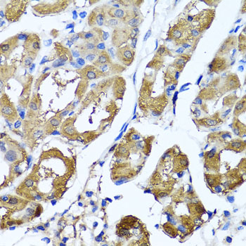 HYAL1 Antibody - Immunohistochemistry of paraffin-embedded human stomach tissue.