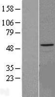 HYAL1 Protein - Western validation with an anti-DDK antibody * L: Control HEK293 lysate R: Over-expression lysate
