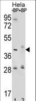 HYAL2 Antibody - Western blot of HYAL2 Antibody antibody pre-incubated without(lane 1) and with(lane 2) blocking peptide in HeLa cell line lysate. HYAL2 Antibody (arrow) was detected using the purified antibody.