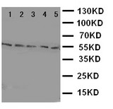HYAL2 Antibody - WB of HYAL2 antibody. Lane 1: HELA Cell Lysate. Lane 2: SMMC Cell Lysate. Lane 3: COLO320 Cell Lysate. Lane 4: MCF-7 Cell Lysate. Lane 5: HT1080 Cell Lysate..