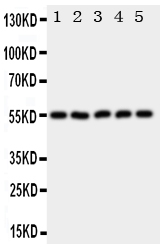 HYAL2 Antibody - Anti-HYAL2 antibody, Western blotting All lanes: Anti HYAL2 at 0.5ug/ml Lane 1: HELA Whole Cell Lysate at 40ug Lane 2: SMMC Whole Cell Lysate at 40ug Lane 3: COLO320 Whole Cell Lysate at 40ug Lane 4: MCF-7 Whole Cell Lysate at 40ug Lane 5: HT1080 Whole Cell Lysate at 40ug Predicted bind size: 54KD Observed bind size: 54KD