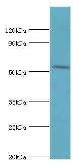 HYAL2 Antibody - Western blot. All lanes: Hyaluronidase-2 antibody at 4 ug/ml+mouse lung tissue. Secondary antibody: Goat polyclonal to rabbit at 1:10000 dilution. Predicted band size: 54 kDa. Observed band size: 54 kDa Immunohistochemistry.