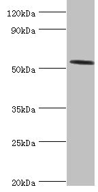 HYAL2 Antibody - Western blot All lanes: Hyaluronidase-2 antibody at 4µg/ml + Mouse lung tissue Secondary Goat polyclonal to rabbit IgG at 1/10000 dilution Predicted band size: 54 kDa Observed band size: 54 kDa