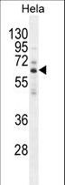 HYAL2 Antibody - HYAL2 Antibody western blot of HeLa cell line lysates (35 ug/lane). The HYAL2 antibody detected the HYAL2 protein (arrow).