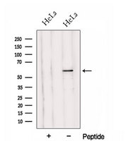 HYAL2 Antibody - Western blot analysis of extracts of HeLa cells using HYAL2 antibody. The lane on the left was treated with blocking peptide.