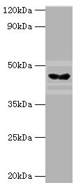 HYAL3 Antibody - Western blot All lanes: HYAL3 antibody at 4µg/ml + Mouse liver tissue Secondary Goat polyclonal to rabbit IgG at 1/10000 dilution Predicted band size: 47, 44, 19, 16 kDa Observed band size: 47 kDa