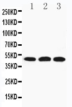 HYAL3 Antibody - WB of HYAL3 antibody. All lanes: Anti-HYAL3 at 0.5ug/ml. Lane 1: 22RV Whole Cell Lysate at 40ug. Lane 2: HELA Whole Cell Lysate at 40ug. Lane 3: V20S Whole Cell Lysate at 40ug. Predicted bind size: 47KD. Observed bind size: 47KD.