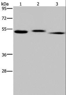 HYAL3 Antibody - Western blot analysis of Human kidney tissue, HepG2 cell and human testis tissue, using HYAL3 Polyclonal Antibody at dilution of 1:400.