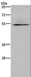 HYAL3 Antibody - Western blot analysis of Human kidney tissue, using HYAL3 Polyclonal Antibody at dilution of 1:400.