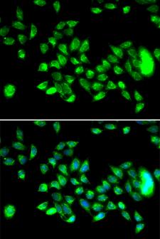 HYAL3 Antibody - Immunofluorescence analysis of U2OS cells using HYAL3 Polyclonal Antibody.