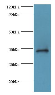 HYLS1 Antibody - Western blot. All lanes: HYLS1 antibody at 8 ug/ml+HeLa whole cell lysate. Secondary antibody: Goat polyclonal to rabbit at 1:10000 dilution. Predicted band size: 34 kDa. Observed band size: 34 kDa.