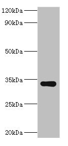 HYLS1 Antibody - Western blot All lanes: HYLS1 antibody at 8µg/ml + Hela whole cell lysate Secondary Goat polyclonal to rabbit IgG at 1/10000 dilution Predicted band size: 34 kDa Observed band size: 34 kDa