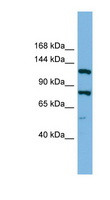 HYOU1 / ORP150 Antibody - HYOU1 / ORP150 antibody Western blot of RPMI-8226 cell lysate. This image was taken for the unconjugated form of this product. Other forms have not been tested.