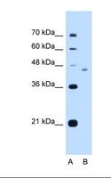 HYPE / FICD Antibody - Lane A: Marker. Lane B: HepG2 cell lysate. Antibody concentration: 2.5 ug/ml. Gel concentration: 12%.  This image was taken for the unconjugated form of this product. Other forms have not been tested.