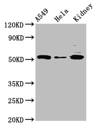 HYPE / FICD Antibody - Positive Western Blot detected in A549 whole cell lysate, Hela whole cell lysate, Rat kidney tissue. All lanes: FICD antibody at 3 µg/ml Secondary Goat polyclonal to rabbit IgG at 1/50000 dilution. Predicted band size: 52 KDa. Observed band size: 52 KDa