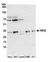 Hypothetical Protein / TINP1 Antibody - Detection of human and mouse NSA2 by western blot. Samples: Whole cell lysate (50 µg) from HeLa, HEK293T, Jurkat, mouse TCMK-1, and mouse NIH 3T3 cells prepared using NETN lysis buffer. Antibody: Affinity purified rabbit anti-NSA2 antibody used for WB at 0.4 µg/ml. Detection: Chemiluminescence with an exposure time of 3 minutes.