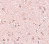 Hypothetical Protein / TINP1 Antibody - Immunohistochemistry of TINP1 in human brain tissue with TINP1 antibody at 5 ug/ml.