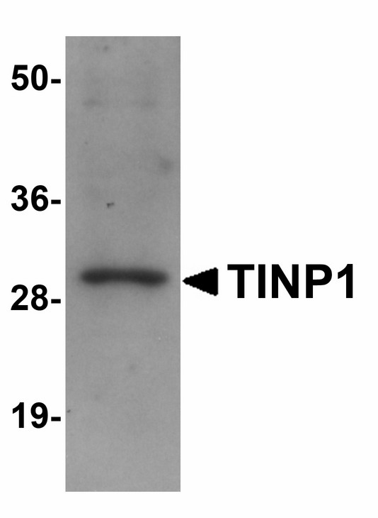 Hypothetical Protein / TINP1 Antibody - Western blot of TINP1 in rat brain tissue lysate with TINP1 antibody at (A) 1 and (B) 2 ug/ml.