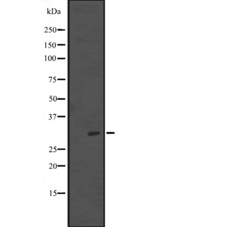 Hypothetical Protein / TINP1 Antibody - Western blot analysis of TINP1 expression in rat brain tissue lysate. The lane on the left is treated with the antigen-specific peptide.