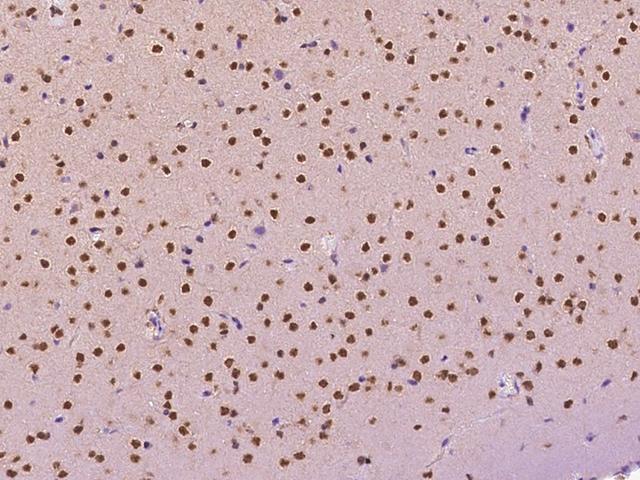 Hypothetical Protein / TINP1 Antibody - Immunochemical staining NSA2 in human brain with rabbit polyclonal antibody at 1:2000 dilution, formalin-fixed paraffin embedded sections.