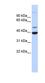 HZF16 / ZNF124 Antibody - ZNF124 antibody Western blot of Fetal Heart lysate. This image was taken for the unconjugated form of this product. Other forms have not been tested.