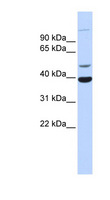 HZF16 / ZNF124 Antibody - ZNF124 antibody Western blot of Fetal Heart lysate. This image was taken for the unconjugated form of this product. Other forms have not been tested.