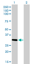 HZF16 / ZNF124 Antibody - Western Blot analysis of ZNF124 expression in transfected 293T cell line by ZNF124 monoclonal antibody (M01), clone 4G4.Lane 1: ZNF124 transfected lysate(33.3 KDa).Lane 2: Non-transfected lysate.