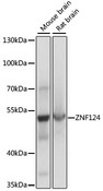 HZF16 / ZNF124 Antibody - Western blot analysis of extracts of various cell lines, using ZNF124 antibody at 1:1000 dilution. The secondary antibody used was an HRP Goat Anti-Rabbit IgG (H+L) at 1:10000 dilution. Lysates were loaded 25ug per lane and 3% nonfat dry milk in TBST was used for blocking. An ECL Kit was used for detection and the exposure time was 1s.