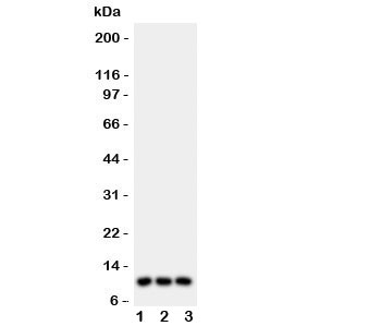 I-309 / CCL1 Antibody - Western blot testing of CCL1 antibody and Lane 1: U87; 2: MCF-7; 3: COLO320 lysate. Expected/observed size ~10KD