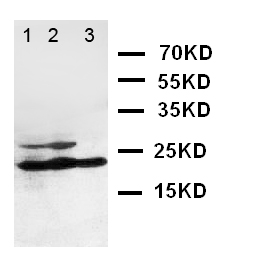 I-309 / CCL1 Antibody - WB of I-309 / CCL1 antibody. Lane 1: SCG Cell Lysate. Lane 2: COLO320 Cell Lysate. Lane 3: JURKAT Cell Lysate.