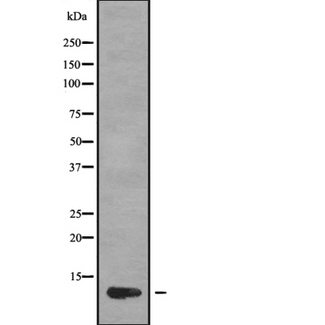 I-309 / CCL1 Antibody - Western blot analysis of CCL1 using MCF-7 whole cells lysates