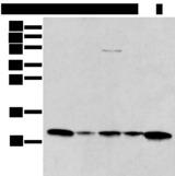 I-309 / CCL1 Antibody - Western blot analysis of A431 Jurkat Lovo and Hepg2 cell Human breast cancer tissue lysates  using CCL1 Polyclonal Antibody at dilution of 1:400