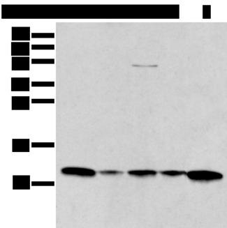 I-309 / CCL1 Antibody - Western blot analysis of A431 Jurkat Lovo and Hepg2 cell Human breast cancer tissue lysates  using CCL1 Polyclonal Antibody at dilution of 1:400