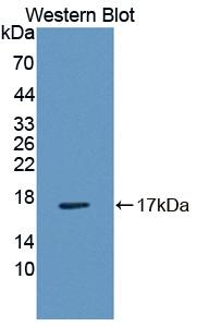 I-BABP / FABP6 Antibody - Western blot of I-BABP / FABP6 antibody.