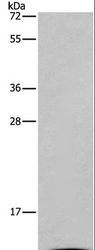 I-BABP / FABP6 Antibody - Western blot analysis of Mouse small intestine tissue, using FABP6 Polyclonal Antibody at dilution of 1:550.