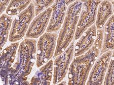 I-BABP / FABP6 Antibody - Immunochemical staining FABP6 in mouse small intestine with rabbit polyclonal antibody at 1:200 dilution, formalin-fixed paraffin embedded sections.
