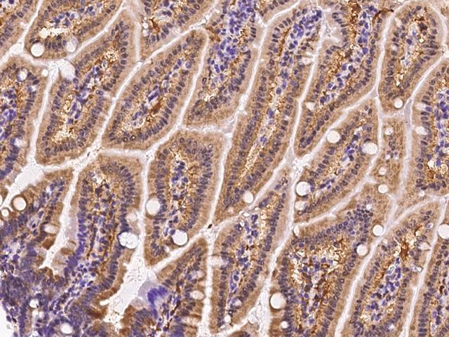 I-BABP / FABP6 Antibody - Immunochemical staining FABP6 in mouse small intestine with rabbit polyclonal antibody at 1:200 dilution, formalin-fixed paraffin embedded sections.