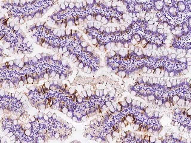 I-BABP / FABP6 Antibody - Immunochemical staining FABP6 in rat small intestine with rabbit polyclonal antibody at 1:200 dilution, formalin-fixed paraffin embedded sections.