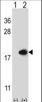 I-FABP / FABP2 Antibody - Western blot of FABP2 (arrow) using rabbit polyclonal FABP2 Antibody. 293 cell lysates (2 ug/lane) either nontransfected (Lane 1) or transiently transfected (Lane 2) with the FABP2 gene.