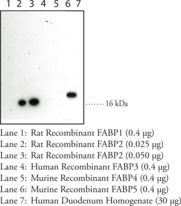 I-FABP / FABP2 Antibody - Western blot of I-FABP / FABP2 antibody.