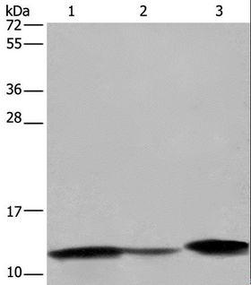 I-FABP / FABP2 Antibody - Western blot analysis of Human fetal intestine, mouse colon and large intestine tissue, using FABP2 Polyclonal Antibody at dilution of 1:450.